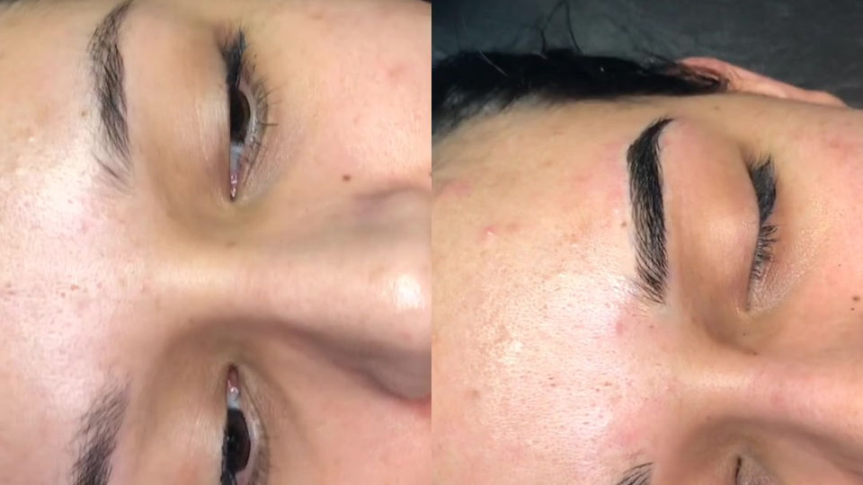 COMBO BROW TRANSFORMATION